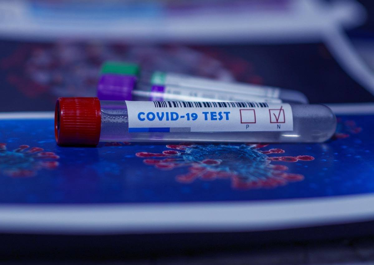 Adenosina contro il Covid-19 - test coronoavirus negativo