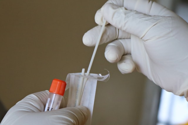 Do it yourself swab - Here comes the test for self-diagnosis of the virus